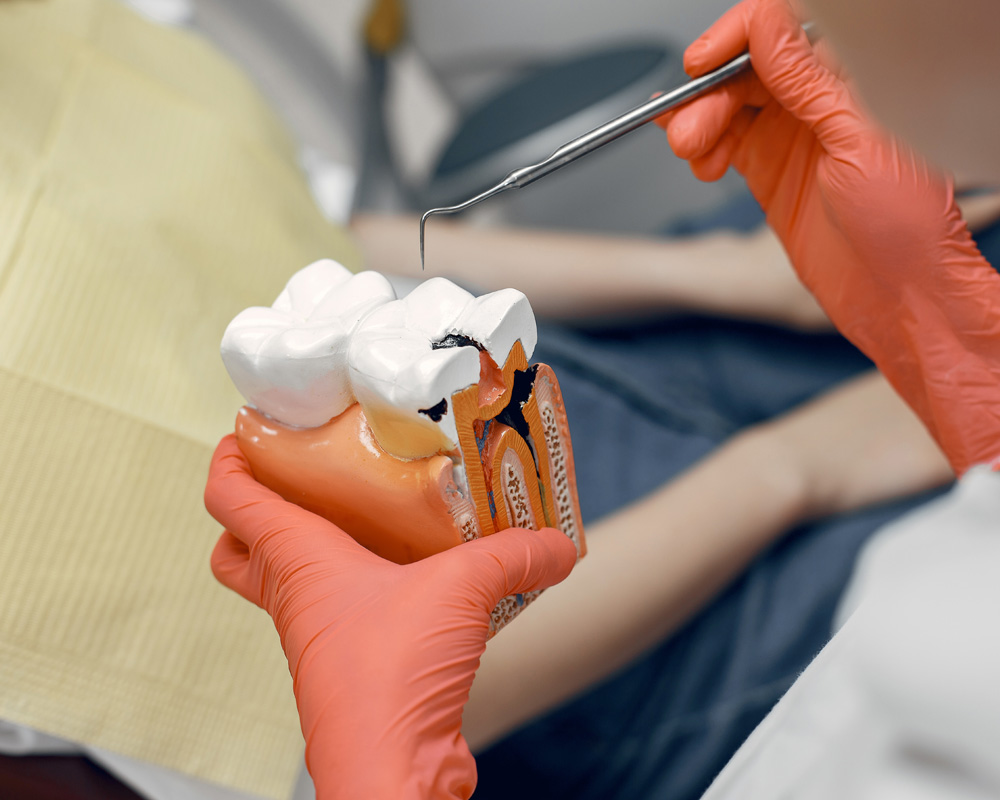 Especialista en endodoncia realizando tratamiento de conductos en el Hospital Recoletas Salud López Cano de Cádiz.