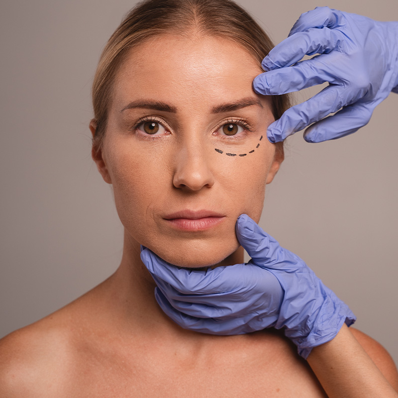 Paciente durante valoración médica para relleno de ojeras con ácido hialurónico.