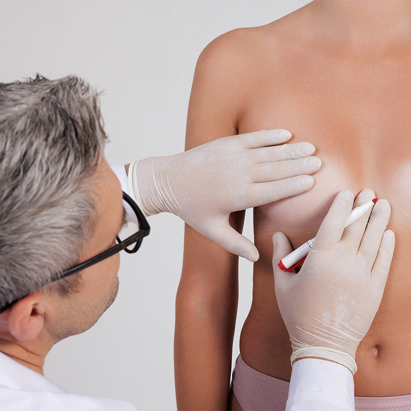 Especialista realizando una valoración médica antes de una cirugía de aumento de pecho.