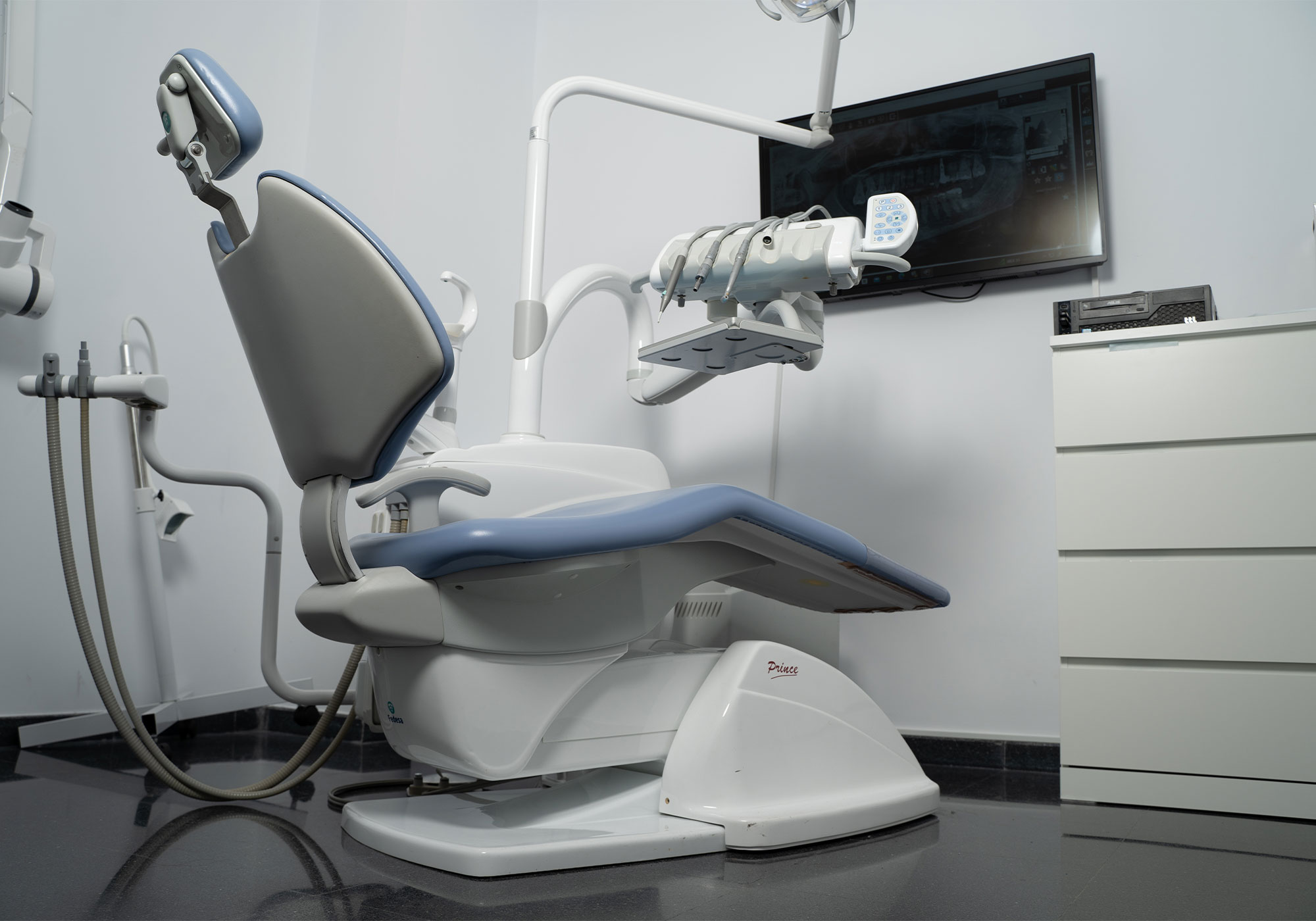 implantes-dental