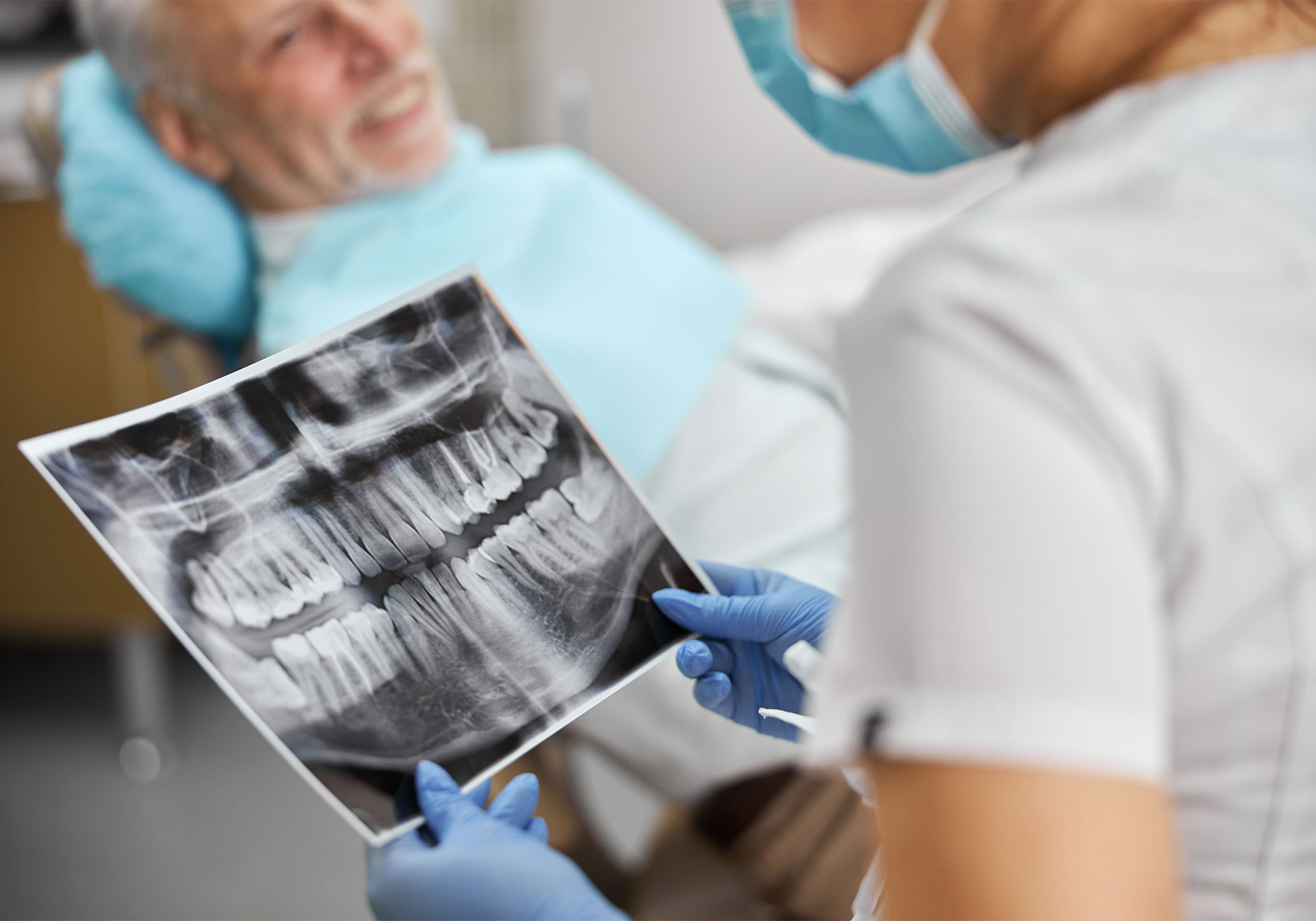 implantes-dental