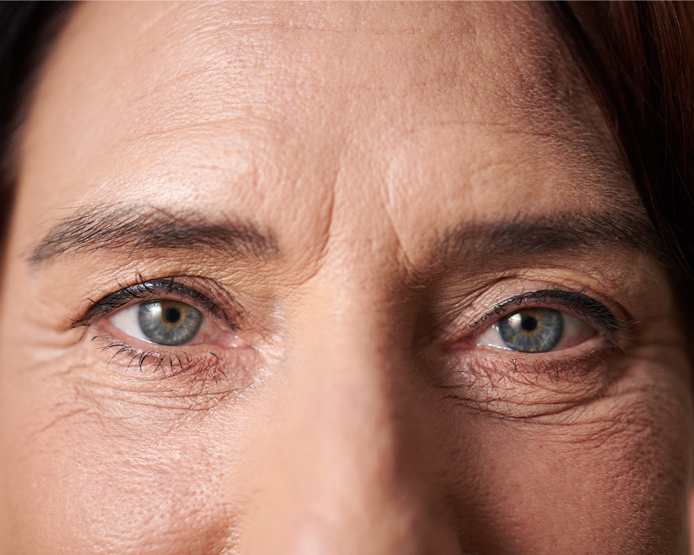 Primer plano de ojos con arrugas de expresión y patas de gallo marcadas.