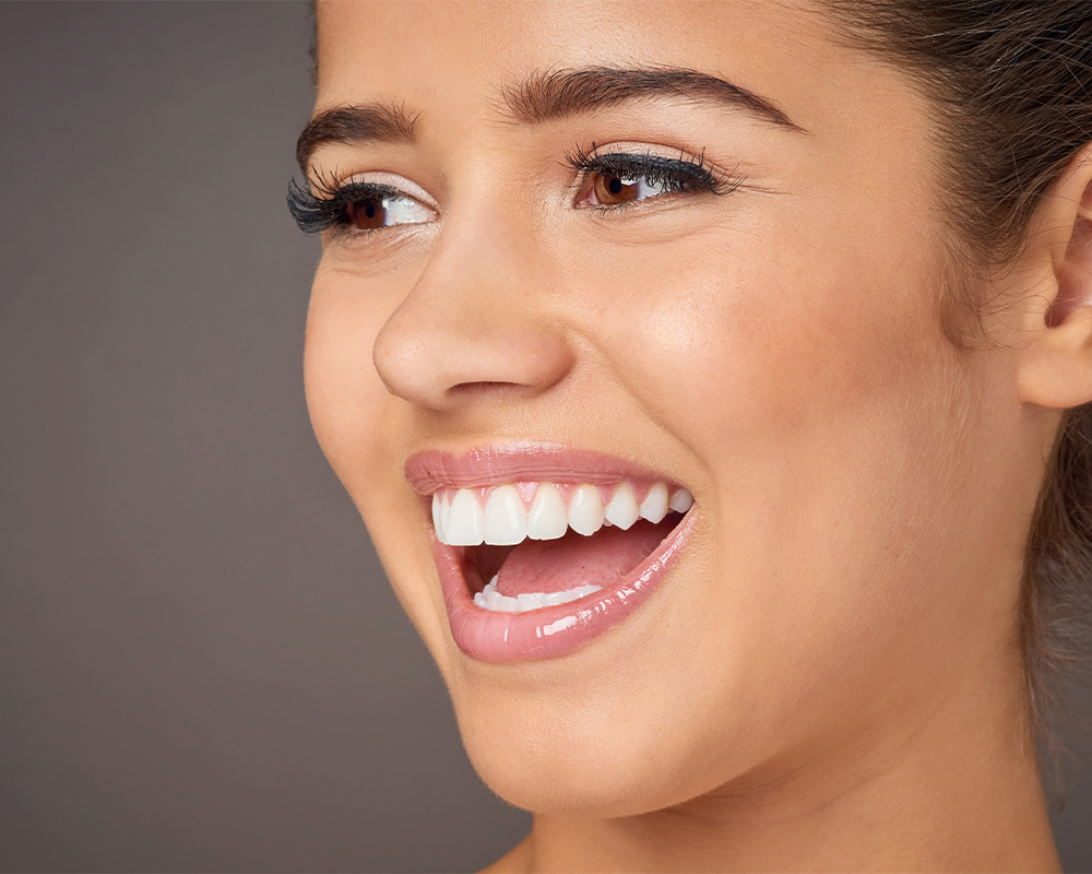 Paciente mostrando una sonrisa blanca tras tratamiento de blanqueamiento dental en Cádiz.