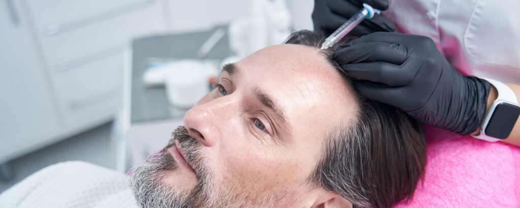 Especialista médico realizando microinyecciones de mesoterapia capilar en el cuero cabelludo de un paciente.