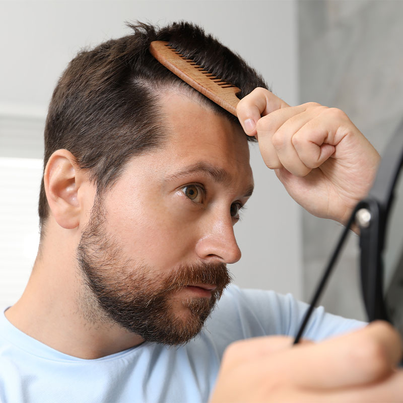 Médico especialista aplicando tratamiento de mesoterapia para fortalecer el cabello en clínica capilar.