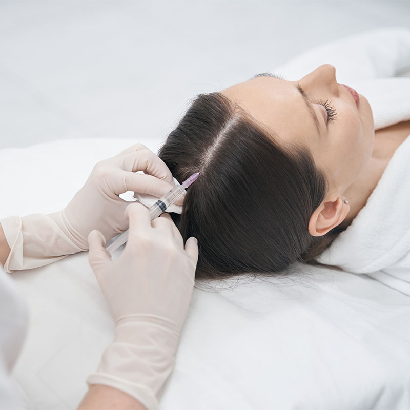Primer plano de aguja de mesoterapia actuando sobre el cuero cabelludo para bioestimulación.