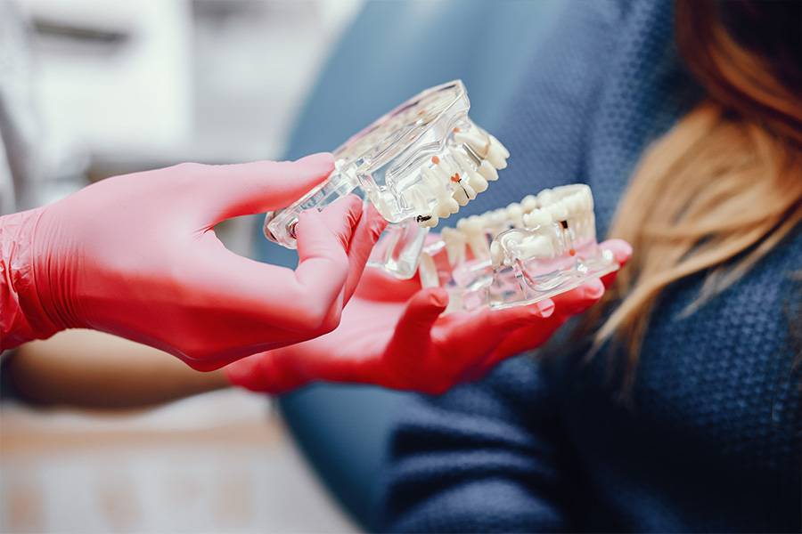 Odontólogo en Cádiz explicando el ajuste de una prótesis dental superior a un paciente.