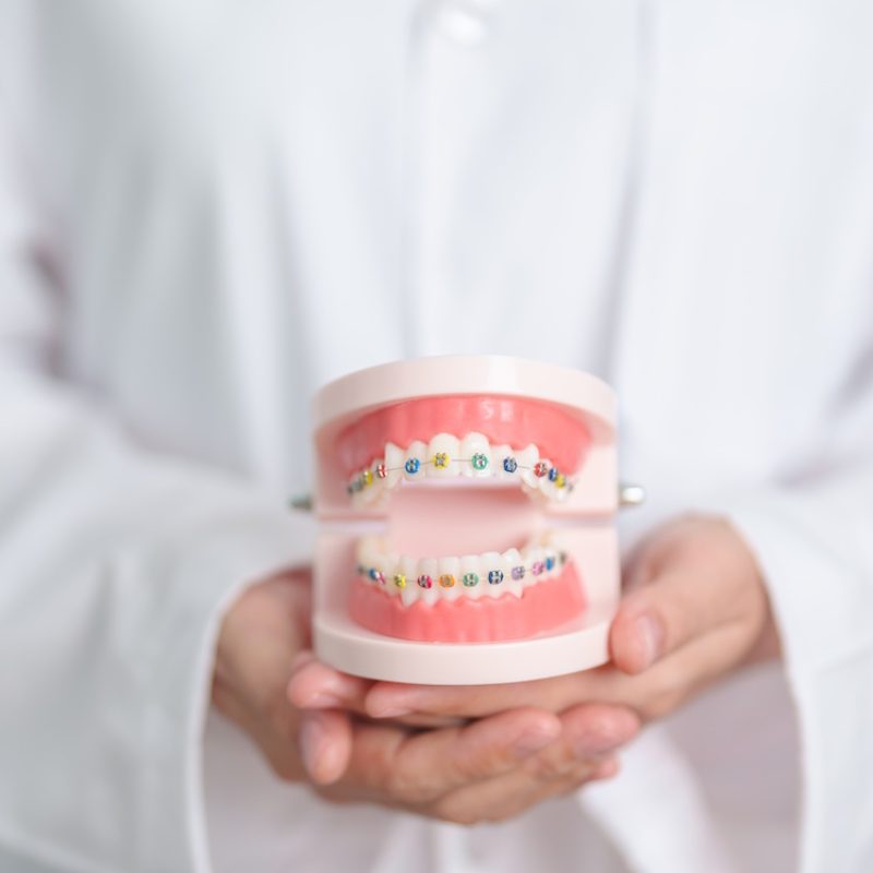 Dentist with Orthodontic tooth model and bracket or brace. Clean and Scrape off tartar. May Orthodontic Health Day, March Oral health, Dentist Day, False Teeth. Toothache and Children Dental Health
