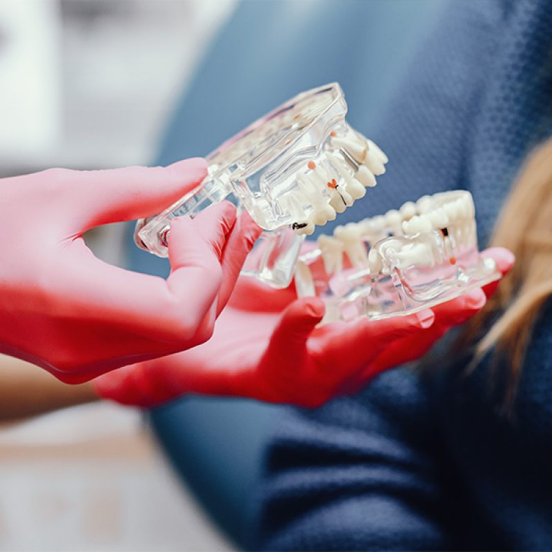 Odontólogo en Cádiz explicando el ajuste de una prótesis dental superior a un paciente.